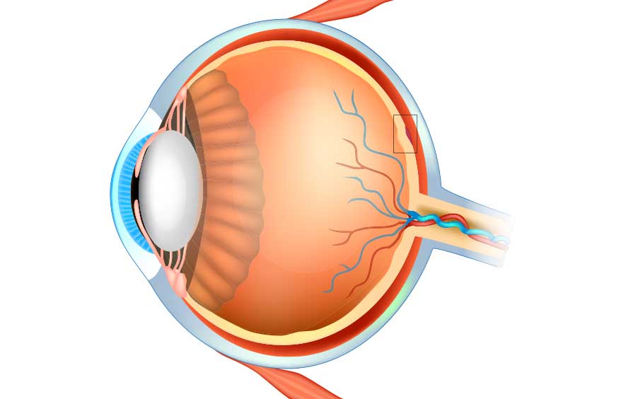 Age-Related Macular Degeneration