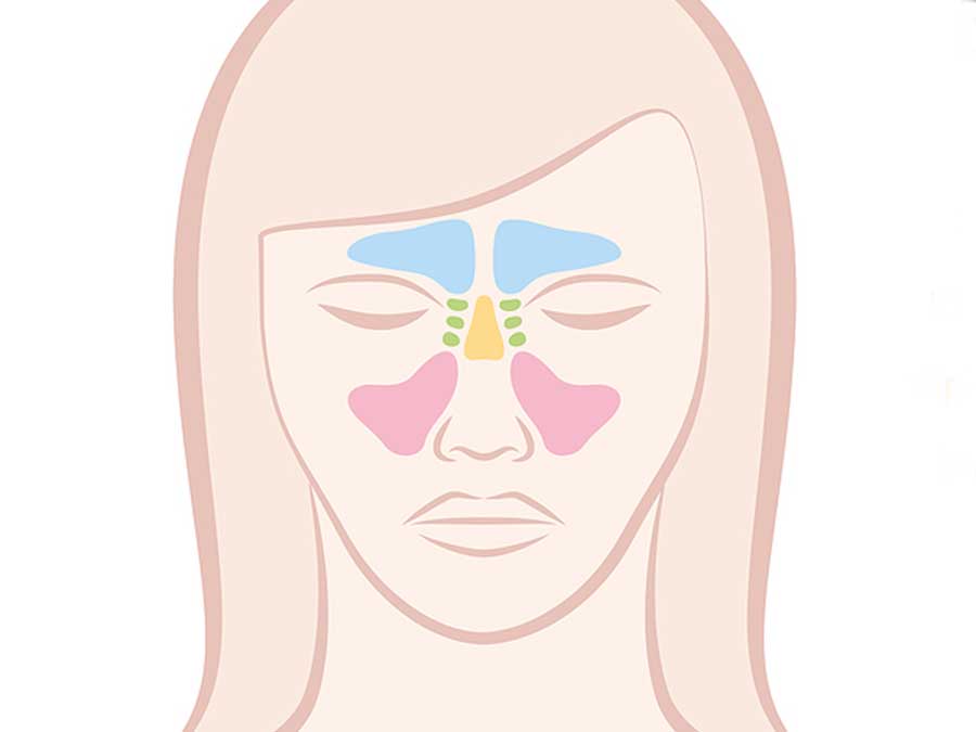 Sinuses